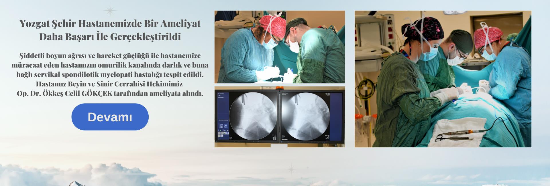 Yozgat Şehir Hastanemizde Bir Ameliyat Daha Başarı İle Gerçekleştirildi